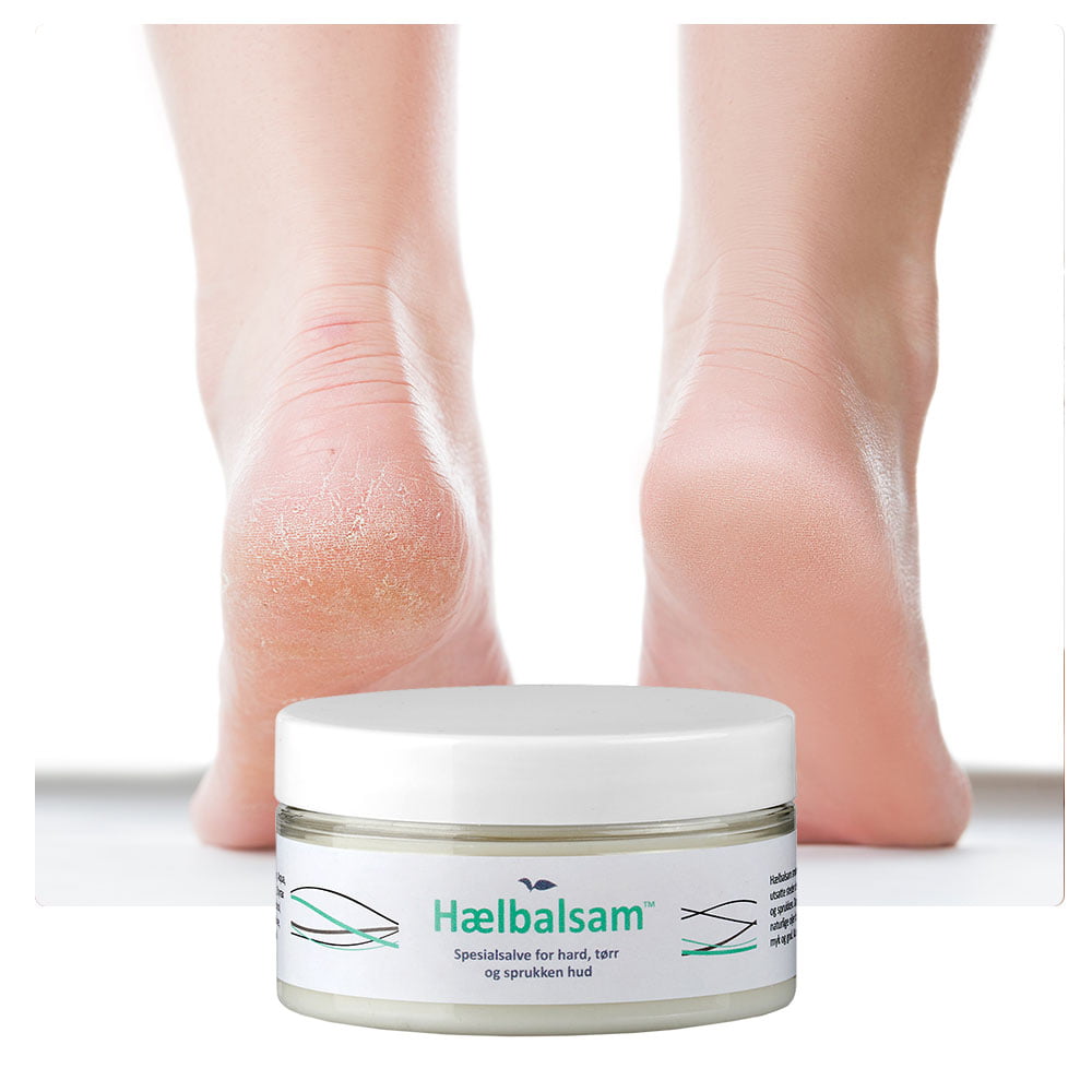 DEAL - 2 stk Hælbalsam 100 ml - Bilde 2