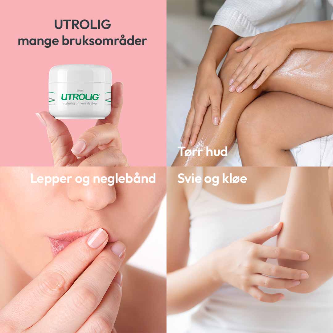 DEAL 2 stk Utrolig Naturlig Universalsalve 50 ml - Bilde 5