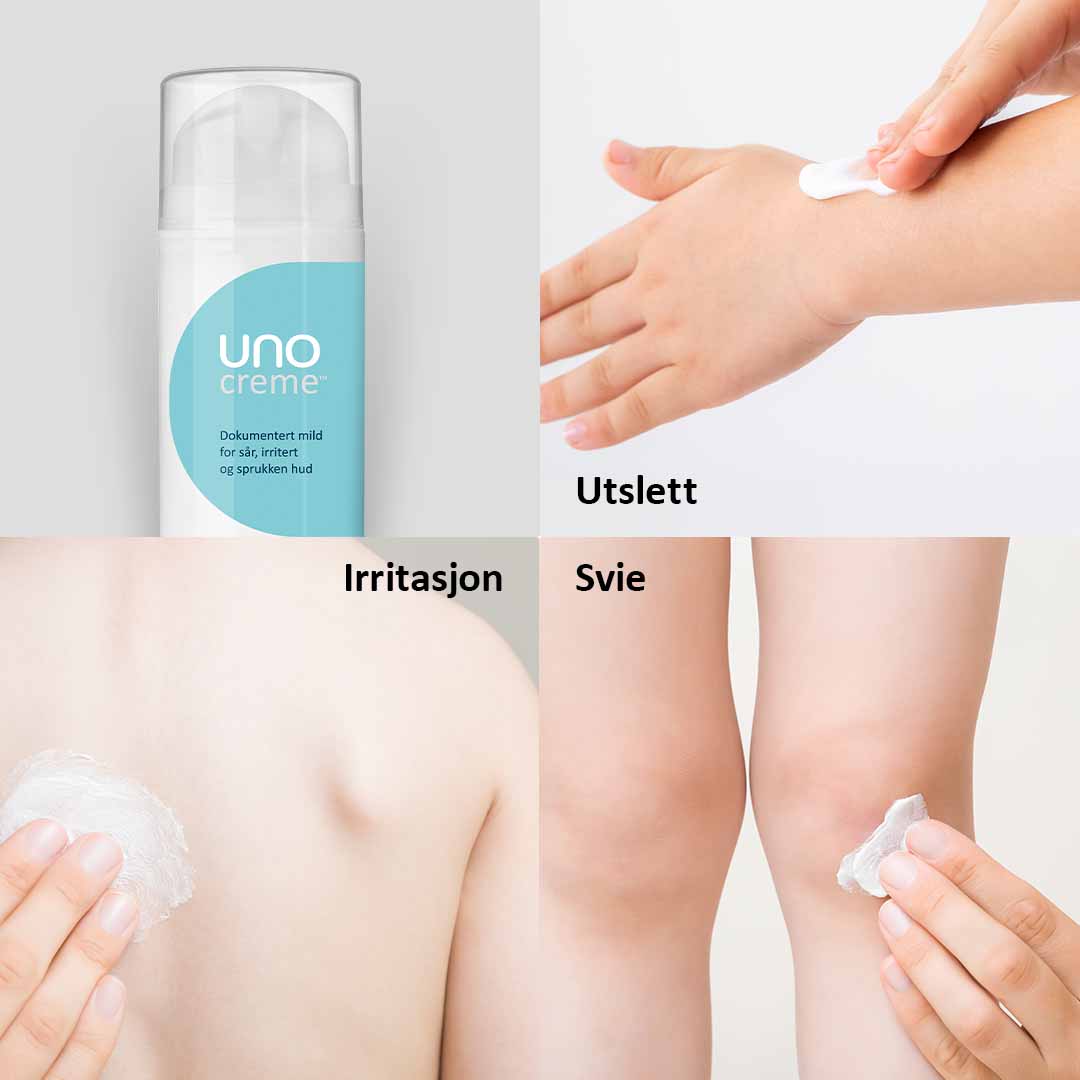 DEAL - UnoCreme - for sår, rød og irritert hud - Bilde 4