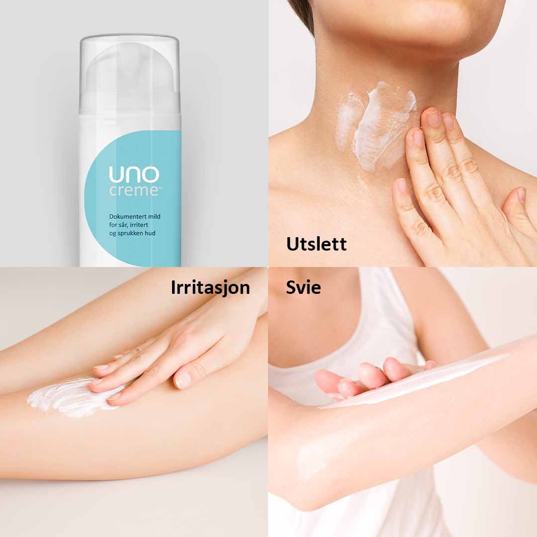 DEAL - UnoCreme - for sår, rød og irritert hud - Bilde 3