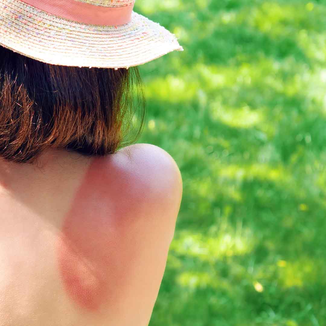 Sommer pakken - Bilde 3