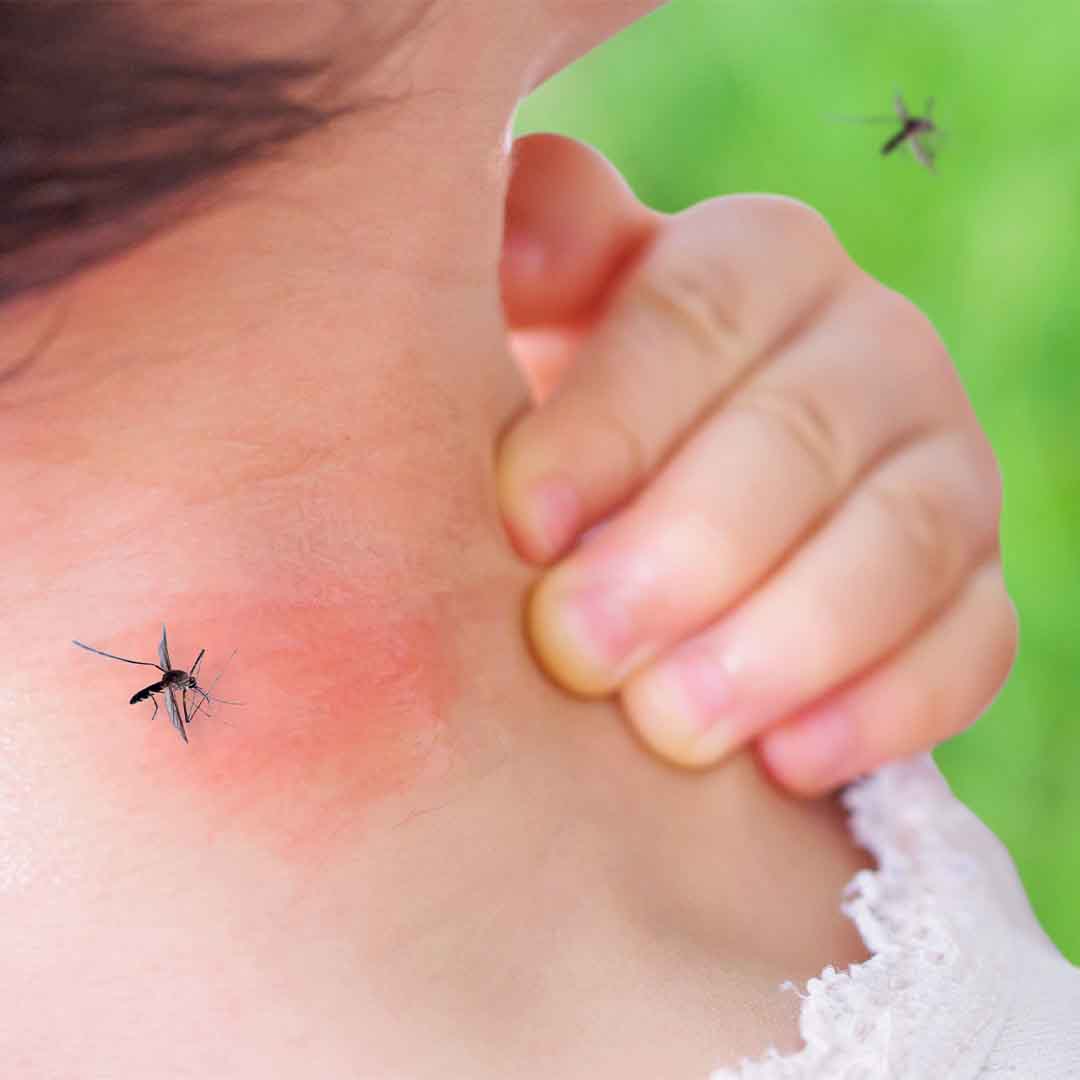 Sommer pakken - Bilde 4