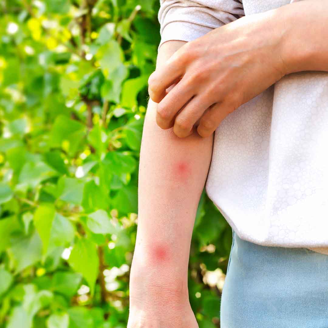 Sommer pakken - Bilde 6